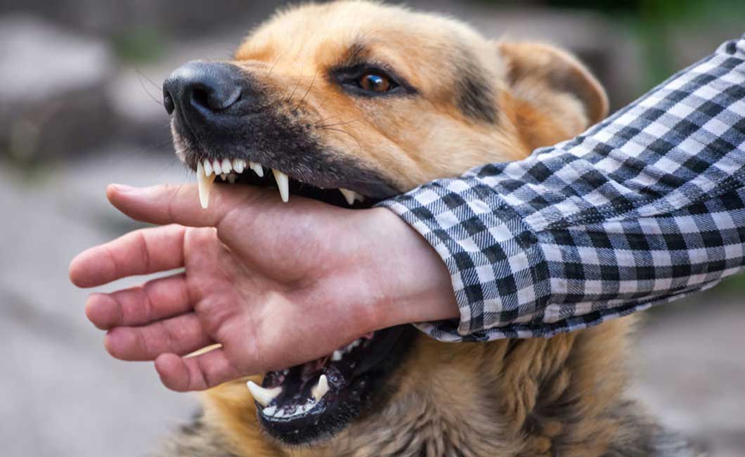 McKinney Dog Bite Lawyer | Dog Bite Injury Lawyer in McKinney, TX