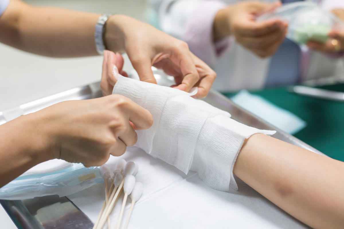 Does Workers’ Compensation Cover Burn Injuries?